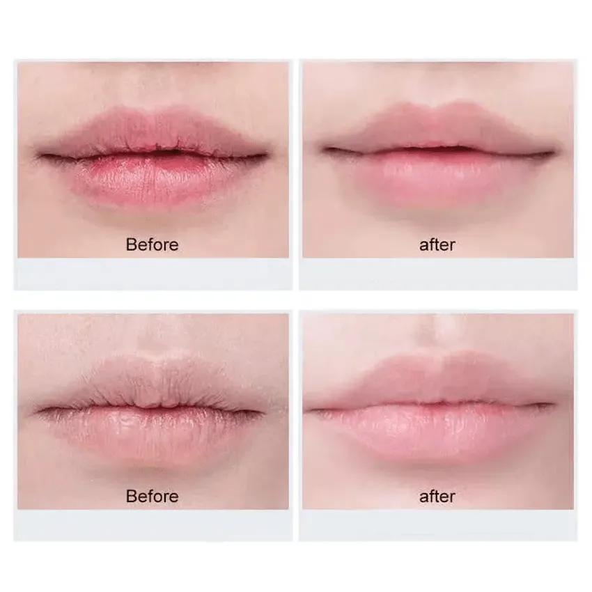 Lip Stories Nourishing Repair - MQO 25 pcs