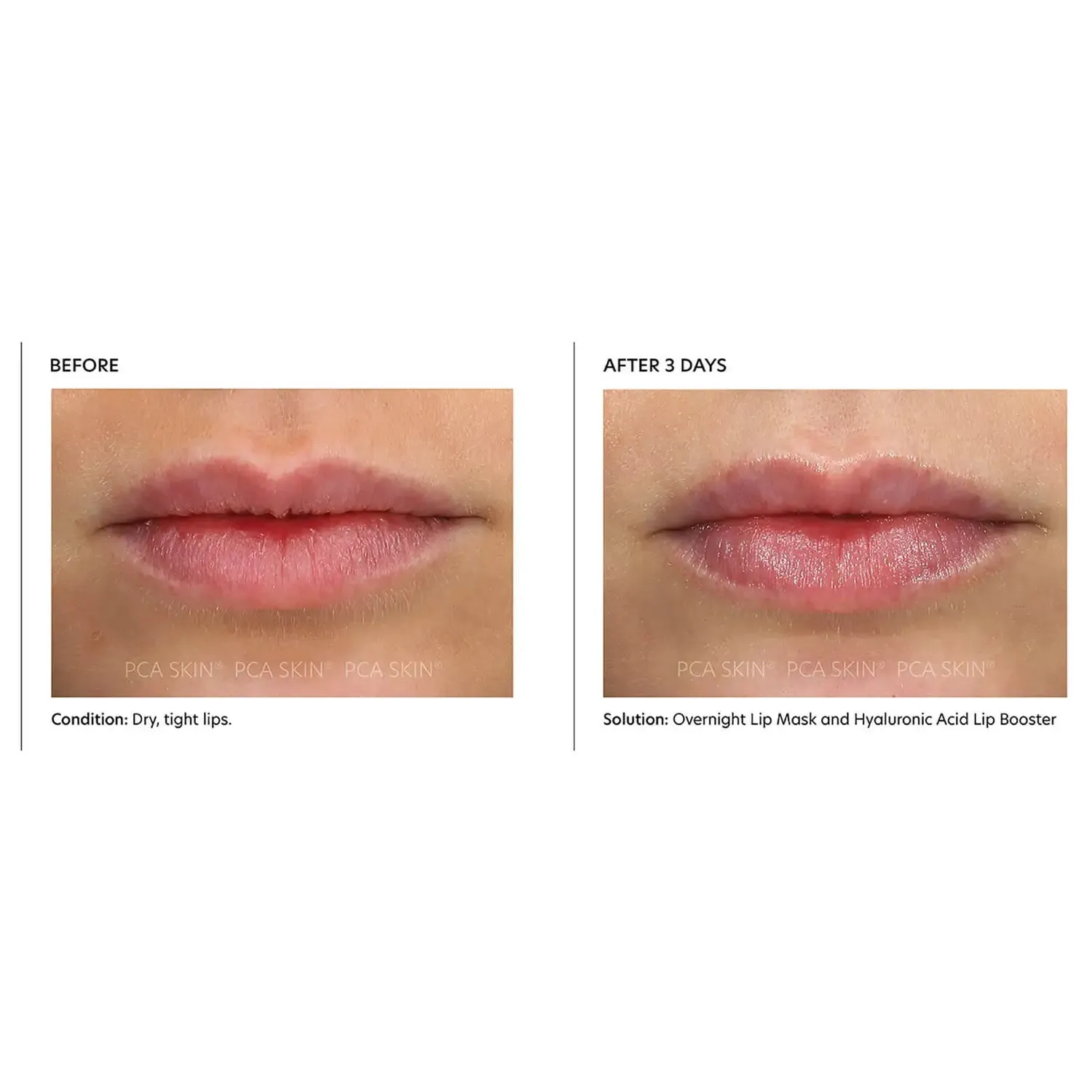 PCA SKIN Overnight Lip Mask