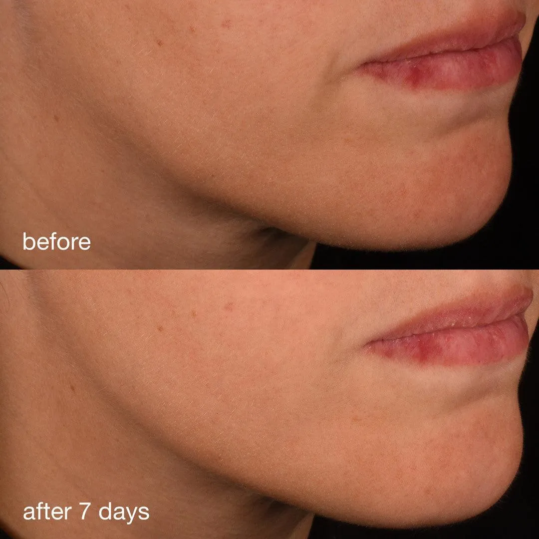 pro-collagen banking serum