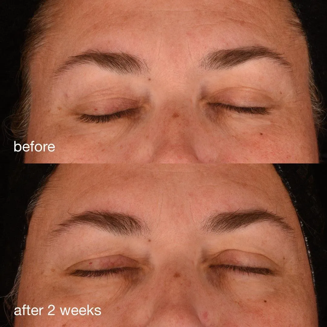 pro-collagen banking serum