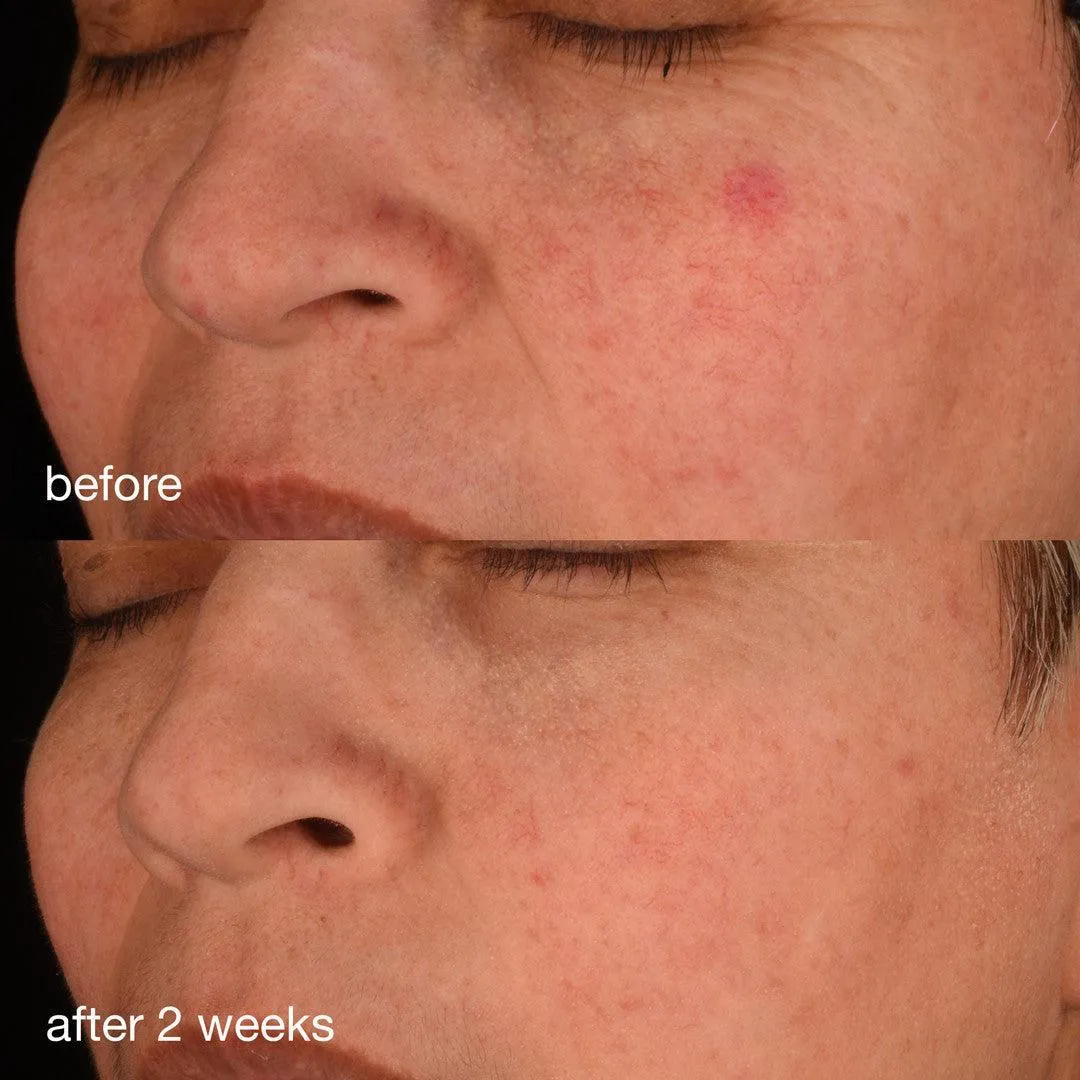 pro-collagen banking serum
